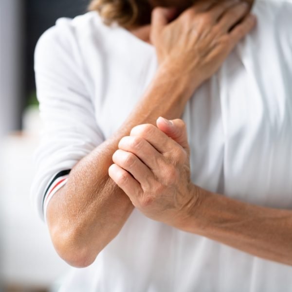 Histamine overgevoeligheid herkennen